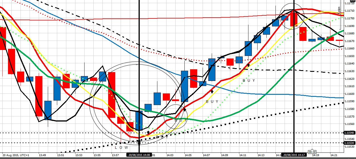 197010d1440101007-my-journal-pathways-improvement-eu-200815-2-00-pm-scalp-example.png